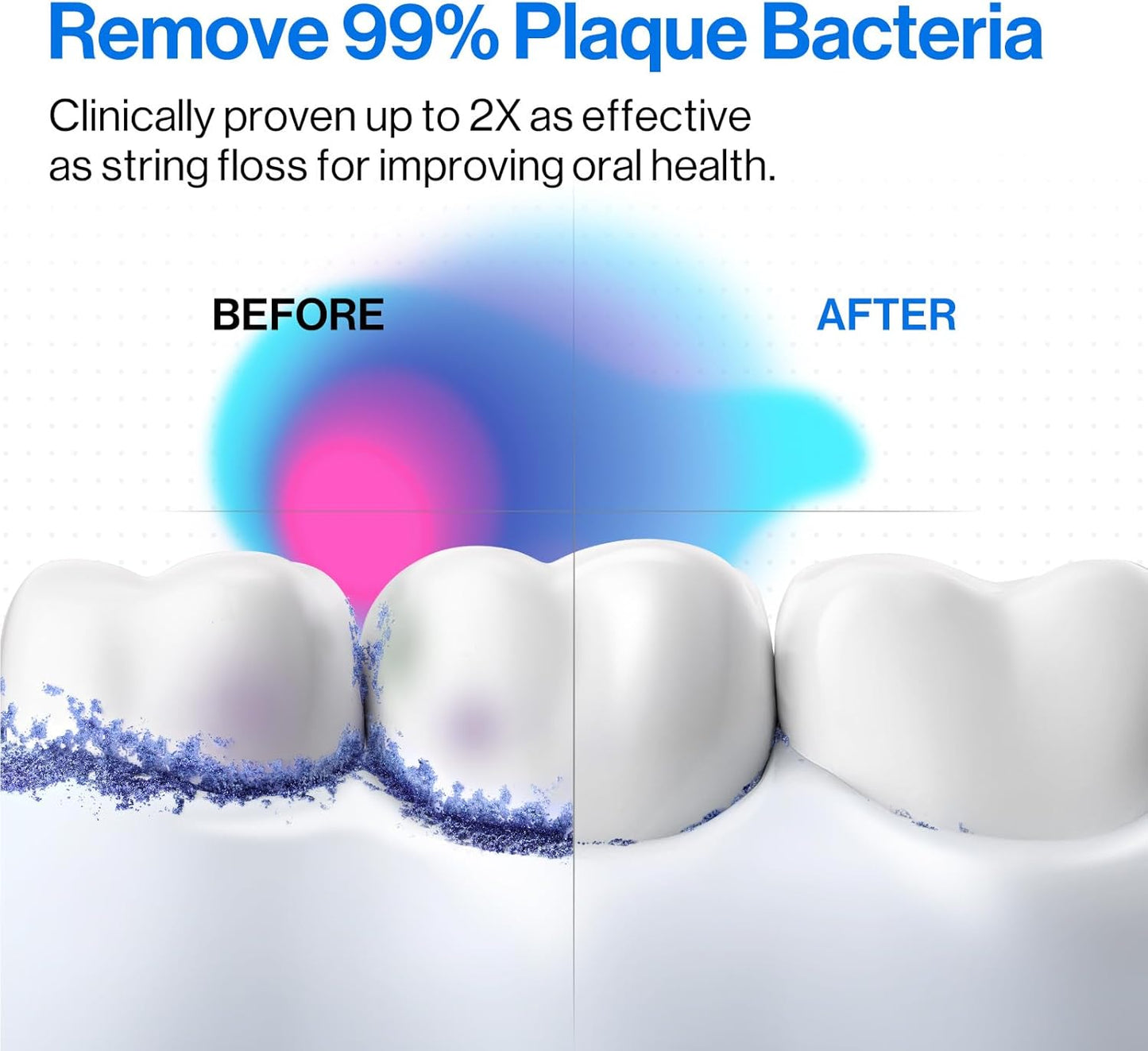 usmile C10 Portable Water Flosser – Travel-Friendly, 95-Day Battery, 4 Modes, 360° Nozzle, 180ml Tank, IPX7 Waterproof, Dentist-Recommended for Braces, Implants & Sensitive Gums (Blue)